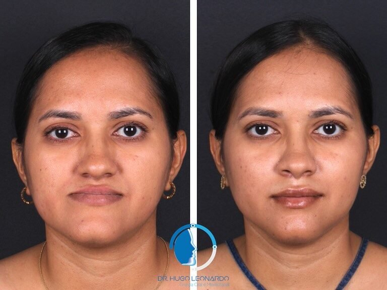 Instagram post from dr.hugo_bucomaxilo. This post is in position 3.