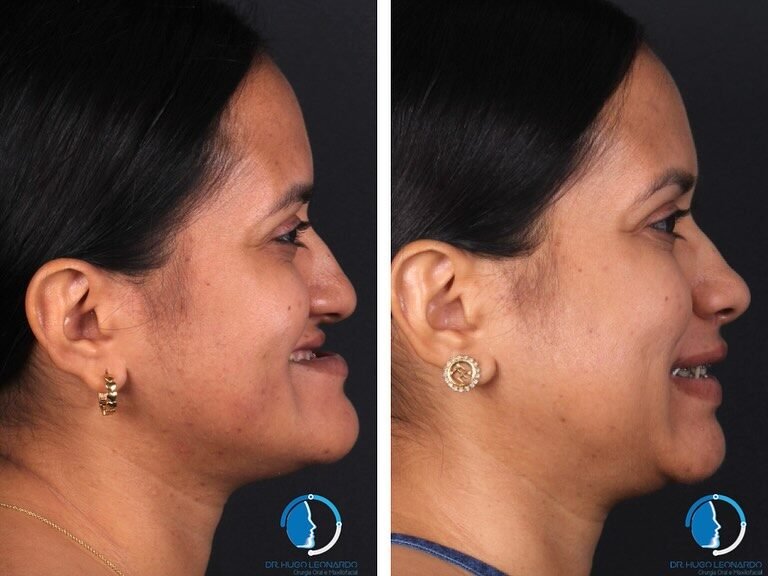 Instagram post from dr.hugo_bucomaxilo. This post is in position 2.